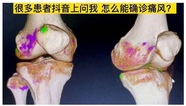 1666584393162506.png image.png