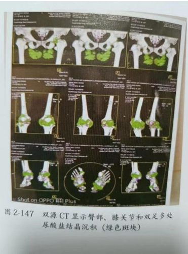 1666584436885867.png image.png